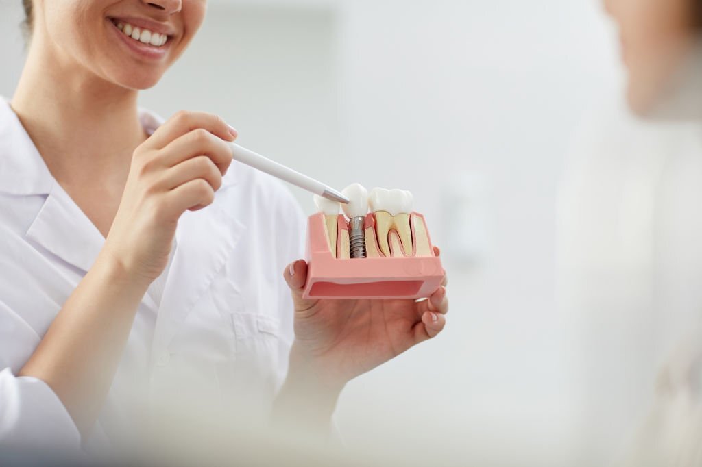 How Dental Implants Can Add To Your Oral Health