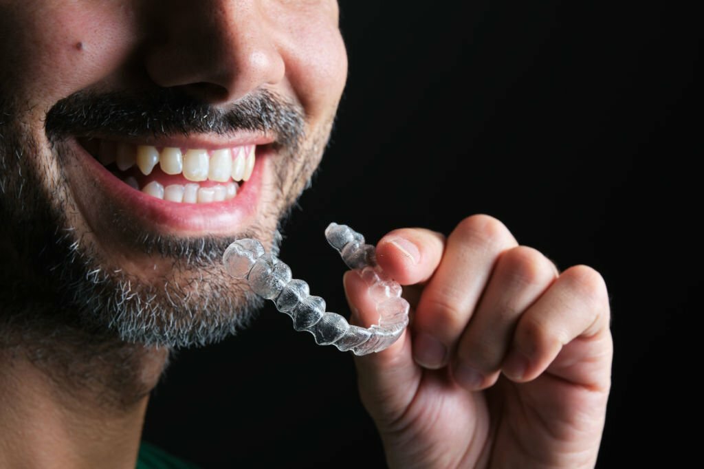Everything You Need To Know About Invisalign In Frisco, TX_FI